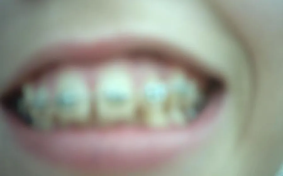 NOPHOTO