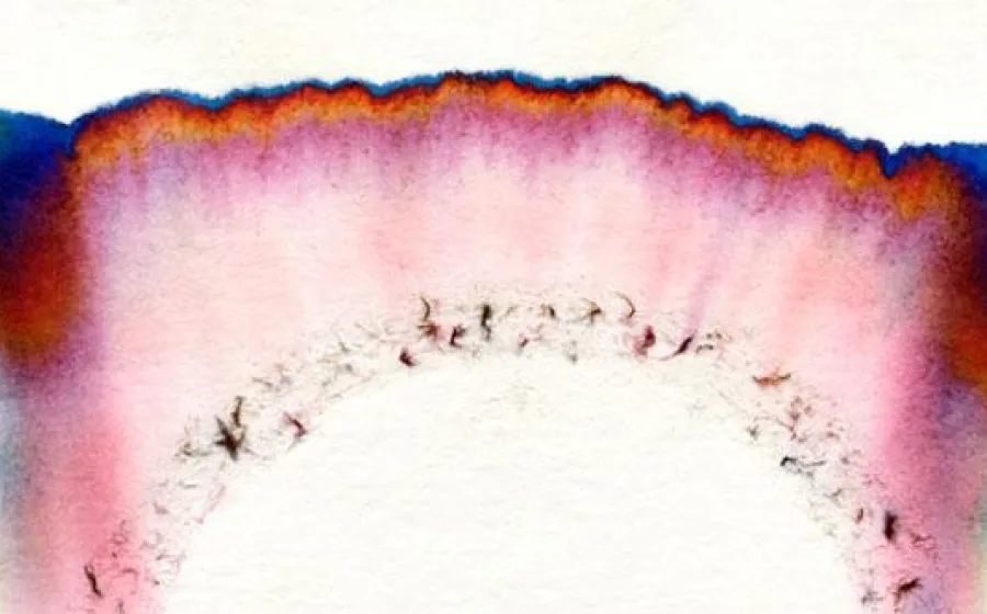 NAVID NUUR. HOCUS FOCUS