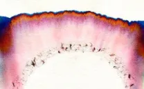 NAVID NUUR. HOCUS FOCUS